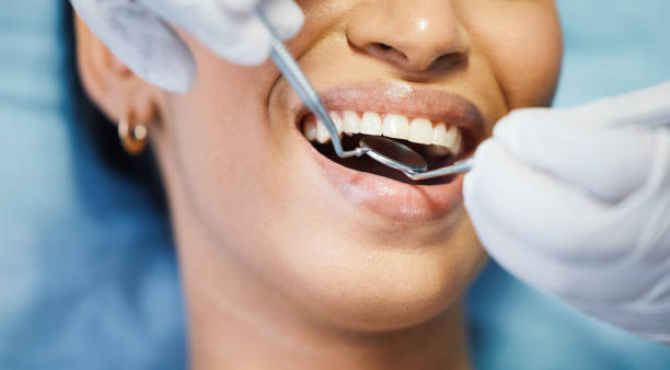 Best Emergency Tooth Extraction in Paramount, CA